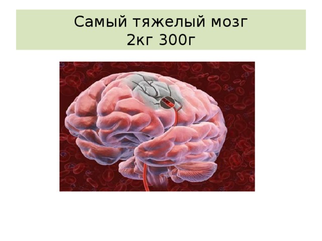 Самый тяжелый мозг  2кг 300г