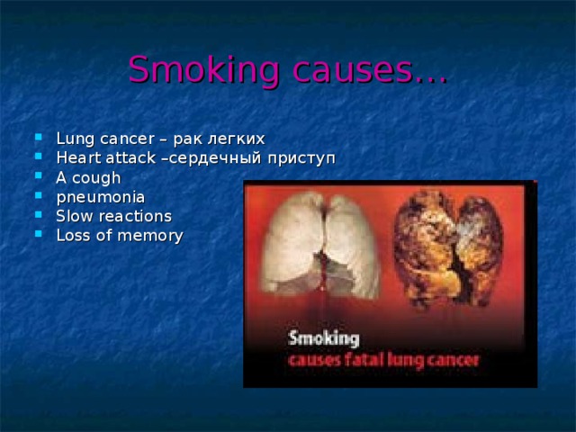 Smoking causes…