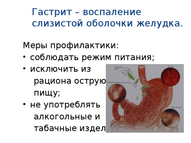 Гастрит – воспаление слизистой оболочки желудка. Меры профилактики: соблюдать режим питания; исключить из  рациона острую  пищу; не употреблять  алкогольные и  табачные изделия;