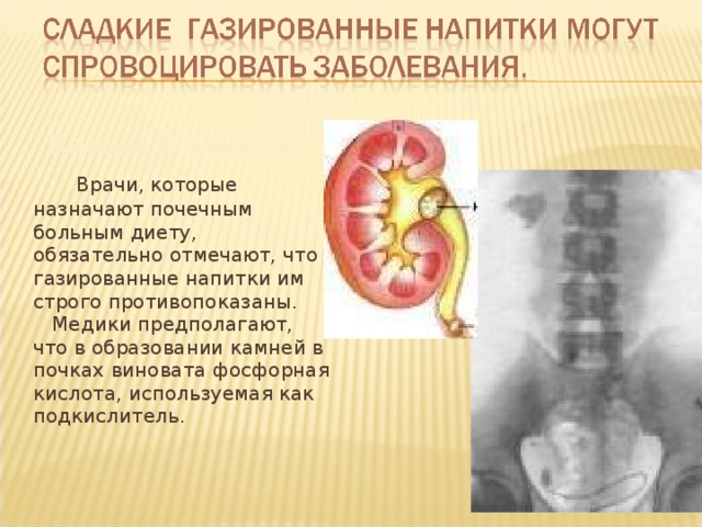 Камни в почках  Врачи, которые назначают почечным больным диету, обязательно отмечают, что газированные напитки им строго противопоказаны. Медики предполагают, что в образовании камней в почках виновата фосфорная кислота, используемая как подкислитель.