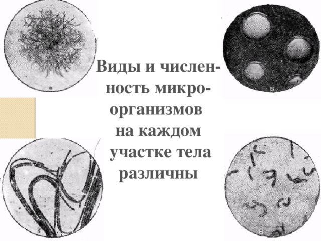 Виды и числен- ность микро- организмов на каждом  участке тела различны