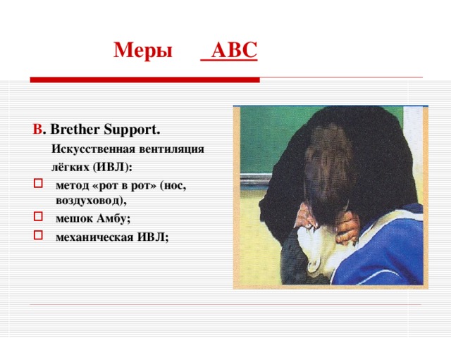 Меры АВС B . Brether Support .  Искусственная вентиляция  лёгких (ИВЛ): метод «рот в рот» (нос, воздуховод), мешок Амбу; механическая ИВЛ;