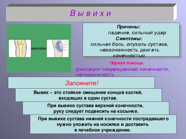 В ы в и х и  Причины: падение, сильный удар Симптомы: сильная боль, опухоль сустава, невозможность двигать конечностью  Первая помощь: фиксация поврежденной конечности, неподвижность Запомните! Вывих – это стойкое смещение концов костей, входящих в один сустав. При вывихе сустава верхней конечности, руку следует подвесить на косынке. При вывихе сустава нижней конечности пострадавшего нужно уложить на носилки и доставить в лечебное учреждение.