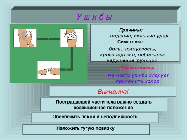 У ш и б ы  Причины: падение, сильный удар Симптомы: боль, припухлость, кровоподтеки, небольшое нарушение функций  Первая помощь: На место ушиба следует приложить холод Внимание! Пострадавшей части тела важно создать возвышенное положение Обеспечить покой и неподвижность Наложить тугую повязку