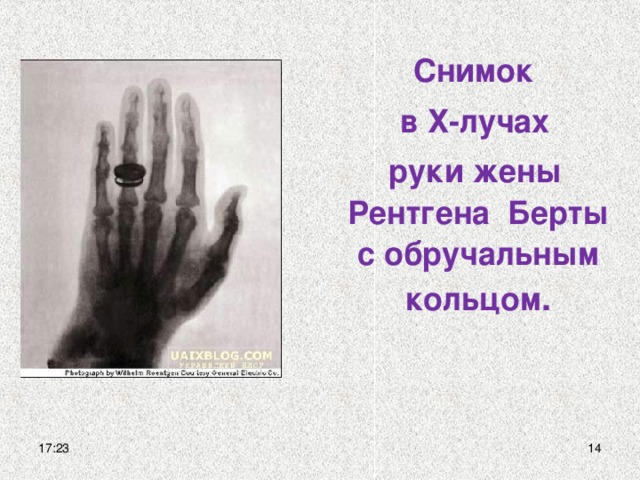 Снимок  в Х-лучах  руки жены Рентгена Берты с обручальным кольцом . 17:23