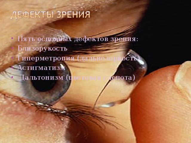 Пять основных дефектов зрения: Близорукость Гиперметропия (дальнозоркость) Астигматизм  Дальтонизм (цветовая слепота)