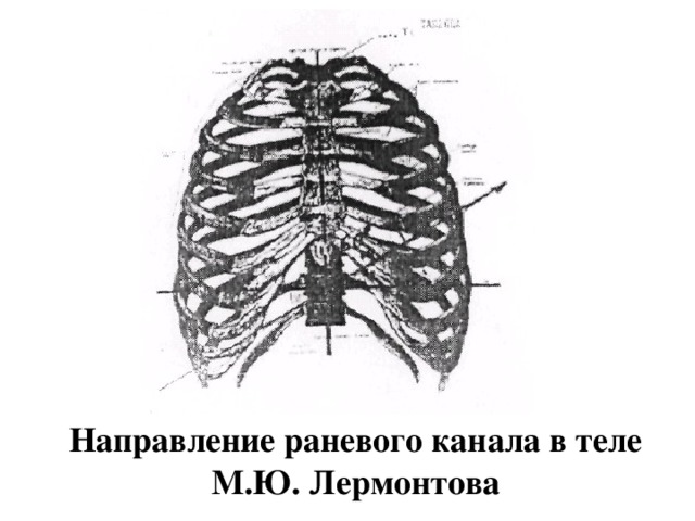 Направление раневого канала в теле М.Ю. Лермонтова