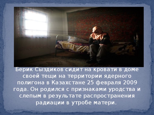 Берик Сыздиков сидит на кровати в доме своей тещи на территории ядерного полигона в Казахстане 25 февраля 2009 года. Он родился с признаками уродства и слепым в результате распространения радиации в утробе матери.