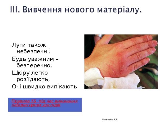 Луги також небезпечні. Будь уважним – безперечно. Шкіру легко роз’їдають, Очі швидко випікають Правила ТБ під час виконання лабораторних дослідів  Шпильова В.В.