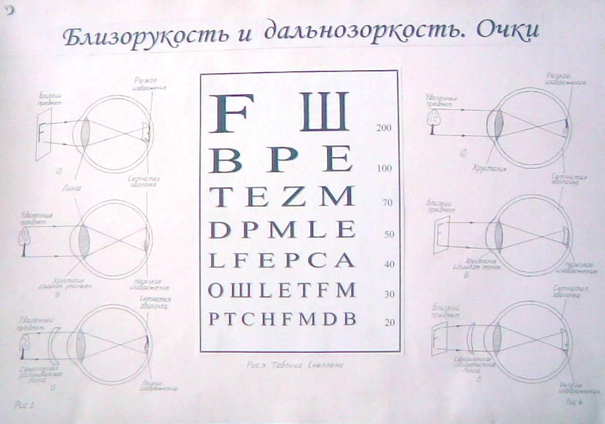 Близорукость и дальнозоркость очки физика 8 класс презентация