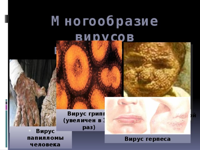 Многообразие вирусов  Болезни человека Вирус гриппа (увеличен в 300 раз) Ребенок, больной оспой Вирус папилломы человека Вирус герпеса