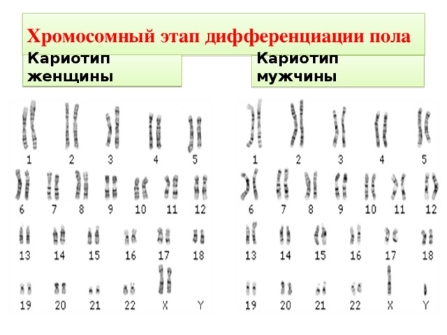 Хромосомный этап дифференциации пола Кариотип женщины Кариотип мужчины