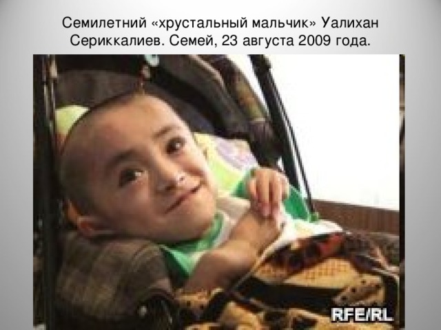 Семилетний «хрустальный мальчик» Уалихан Сериккалиев. Семей, 23 августа 2009 года.