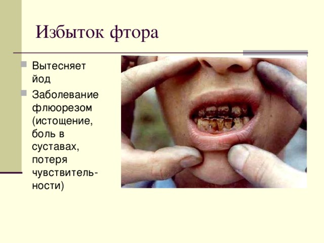 Вытесняет йод Заболевание флюорезом (истощение, боль в суставах, потеря чувствитель-ности)