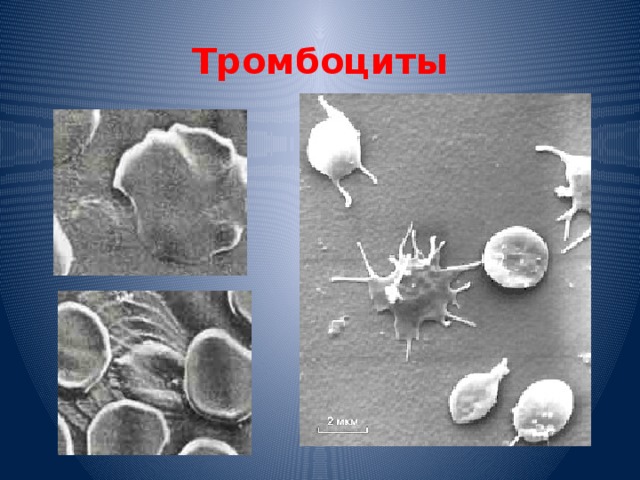 Как выглядит тромбоцит под микроскопом фото