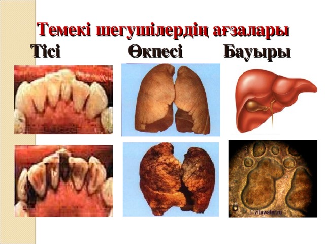 Темекі шегушілердің ағзалары  Тісі Өкпесі Бауыры