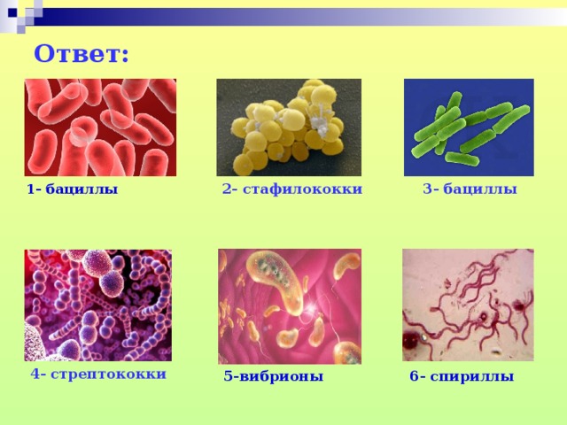 Ответ:   2- стафилококки  3- бациллы 1- бациллы 4- стрептококки 6- спириллы 5-вибрионы