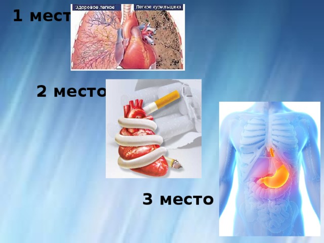 1 место 2 место 3 место