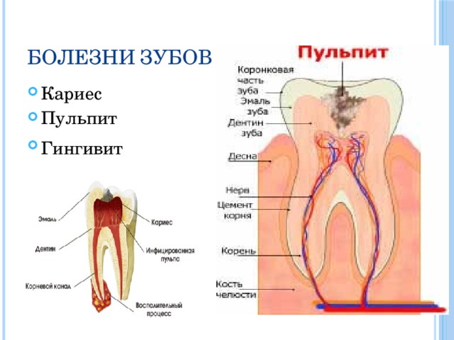 Болезни зубов