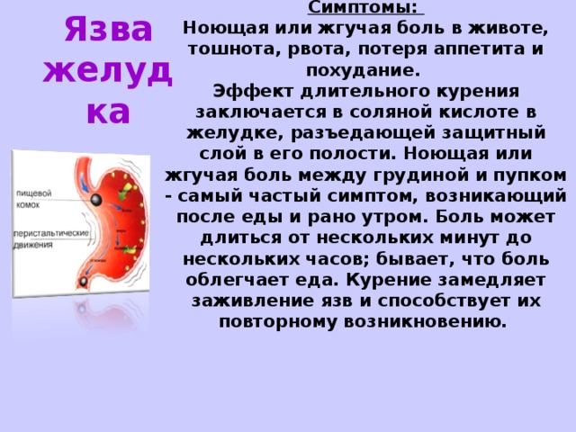 Симптомы:  Ноющая или жгучая боль в животе, тошнота, рвота, потеря аппетита и похудание.  Эффект длительного курения заключается в соляной кислоте в желудке, разъедающей защитный слой в его полости. Ноющая или жгучая боль между грудиной и пупком - самый частый симптом, возникающий после еды и рано утром. Боль может длиться от нескольких минут до нескольких часов; бывает, что боль облегчает еда. Курение замедляет заживление язв и способствует их повторному возникновению.    Язва желудка