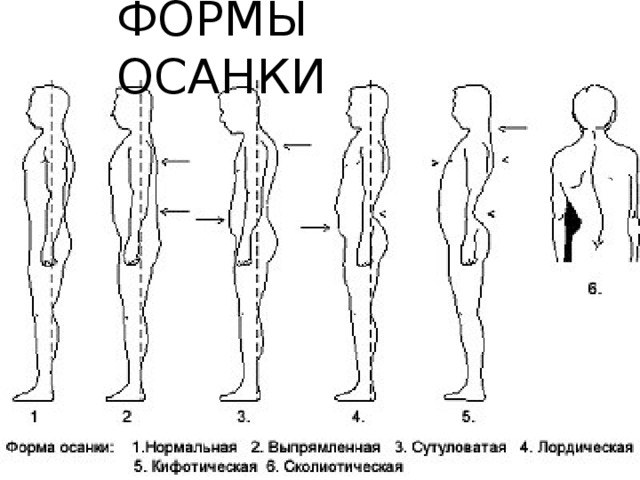 ФОРМЫ ОСАНКИ