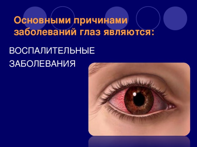 Основными причинами заболеваний глаз являются: ВОСПАЛИТЕЛЬНЫЕ ЗАБОЛЕВАНИЯ