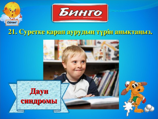 21 . Суретке қарап аурудың түрін анықтаңыз. Даун синдромы