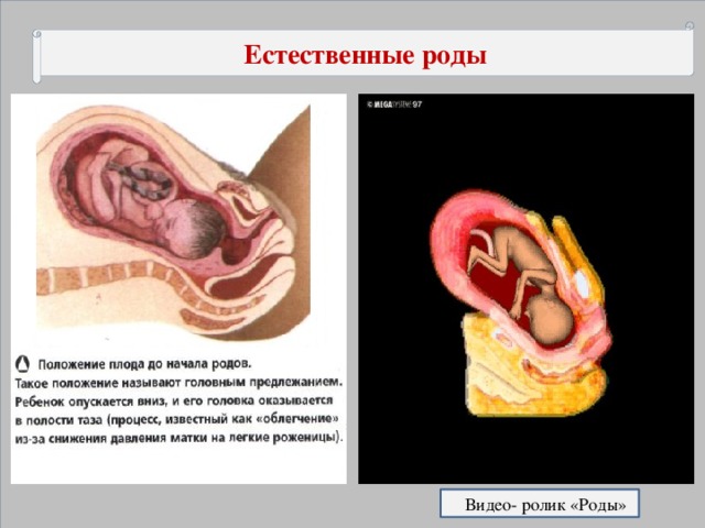 Естественные роды  Видео- ролик «Роды»