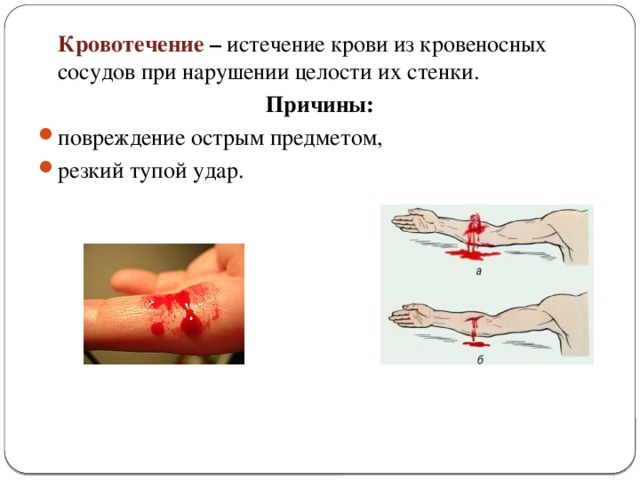 Кровотечение  – истечение крови из кровеносных сосудов при нарушении целости их стенки. Причины: