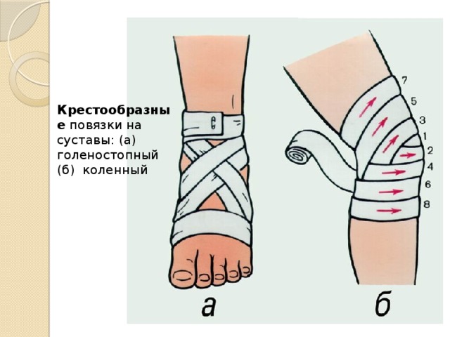 Крестообразные повязки на суставы: (а) голеностопный (б) коленный