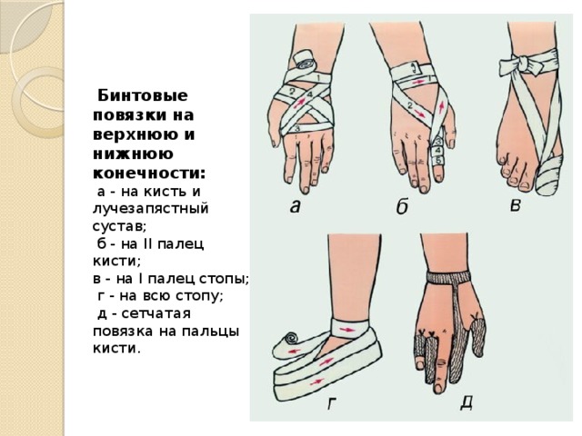 Бинтовые повязки на верхнюю и нижнюю конечности:  а - на кисть и лучезапястный сустав;  б - на II палец кисти; в - на I палец стопы;  г - на всю стопу;  д - сетчатая повязка на пальцы кисти.