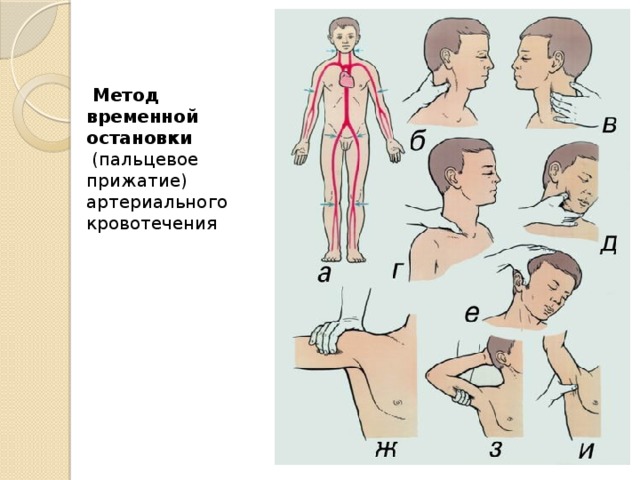 Метод временной остановки  (пальцевое прижатие) артериального кровотечения