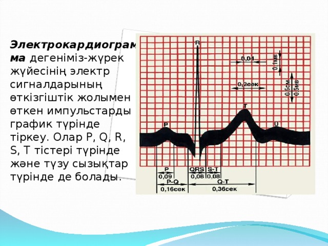 Электрокардиограмма дегеніміз-жүрек жүйесінің электр сигналдарының өткізгіштік жолымен өткен импульстарды график түрінде тіркеу. Олар Р, Q, R, S, T тістері түрінде және түзу сызықтар түрінде де болады.
