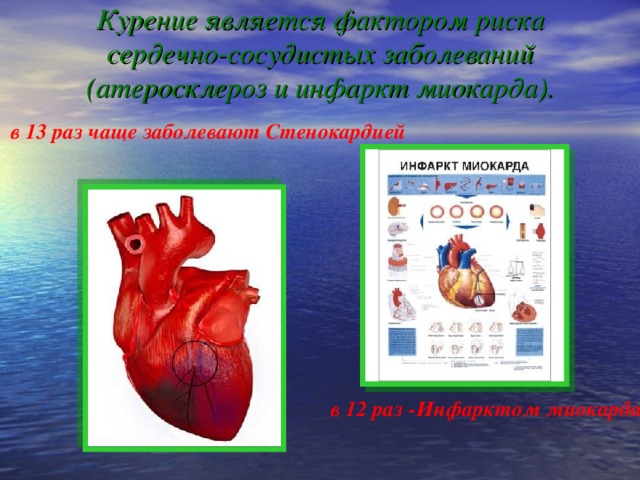 Курение является фактором риска сердечно-сосудистых заболеваний (атеросклероз и инфаркт миокарда).    в 13 раз чаще заболевают Стенокардией в 13 раз чаще заболевают Стенокардией в 13 раз чаще заболевают Стенокардией в 13 раз чаще заболевают Стенокардией в 13 раз чаще заболевают Стенокардией в 12 раз -Инфарктом миокарда