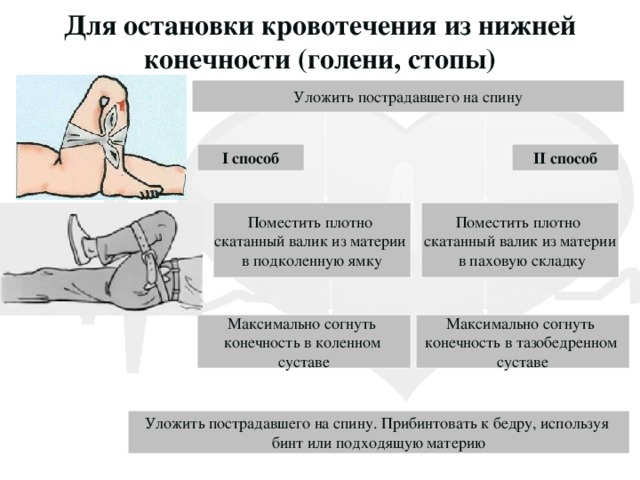 Для остановки кровотечения из нижней конечности (голени, стопы) Уложить пострадавшего на спину I способ II способ Поместить плотно Поместить плотно скатанный валик из материи скатанный валик из материи в подколенную ямку  в паховую складку Максимально согнуть Максимально согнуть конечность в тазобедренном конечность в коленном суставе суставе Уложить пострадавшего на спину. Прибинтовать к бедру, используя бинт или подходящую материю