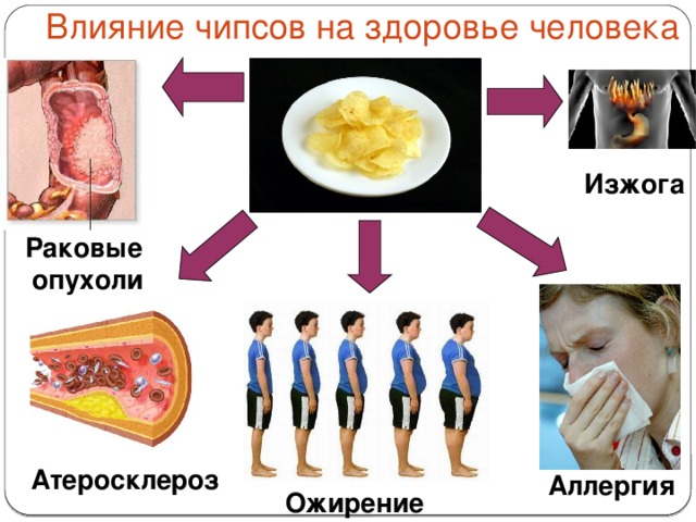 Влияние чипсов на здоровье человека Изжога Раковые опухоли Атеросклероз Аллергия Ожирение