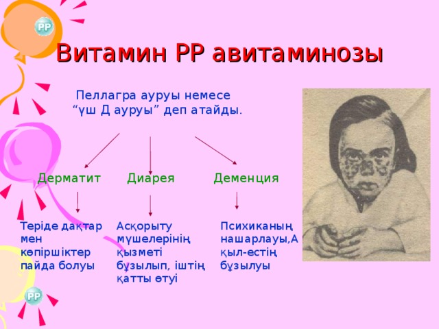 Витамин РР авитаминозы  Пеллагра ауруы немесе “үш Д ауруы” деп атайды. Деменция Диарея Дерматит Теріде дақтар мен көпіршіктер пайда болуы Асқорыту мүшелерінің қызметі бұзылып, іштің қатты өтуі Психиканың нашарлауы,Ақыл-естің бұзылуы 26