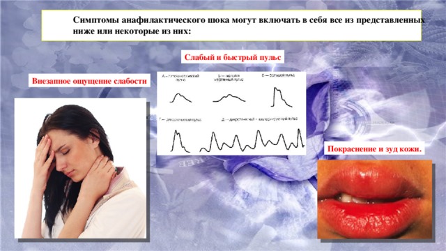 Симптомы анафилактического шока могут включать в себя все из представленных ниже или некоторые из них: Слабый и быстрый пульс Внезапное ощущение слабости Покраснение и зуд кожи.
