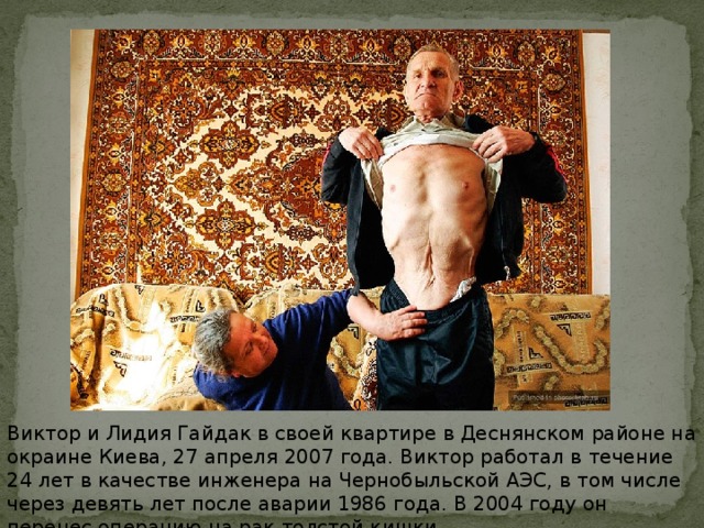Виктор и Лидия Гайдак в своей квартире в Деснянском районе на окраине Киева, 27 апреля 2007 года. Виктор работал в течение 24 лет в качестве инженера на Чернобыльской АЭС, в том числе через девять лет после аварии 1986 года. В 2004 году он перенес операцию на рак толстой кишки.