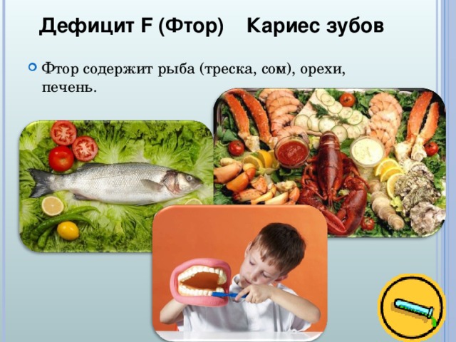 Дефицит F (Фтор) Кариес зубов