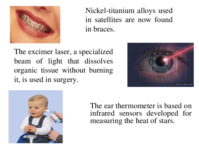 Nickel-titanium alloys used in satellites are now found in braces. The excimer laser, a specialized beam of light that dissolves organic tissue without burning it, is used in surgery. The ear thermometer is based on infrared sensors developed for measuring the heat of stars.