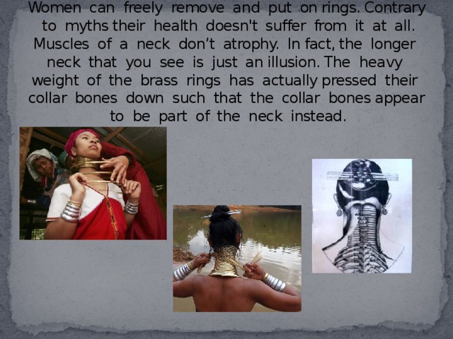 Women can freely remove and put on rings. Contrary to myths their health doesn't suffer from it at all. Muscles of a neck don’t atrophy. In fact, the longer neck that you see is just an illusion. The heavy weight of the brass rings has actually pressed their collar bones down such that the collar bones appear to be part of the neck instead.
