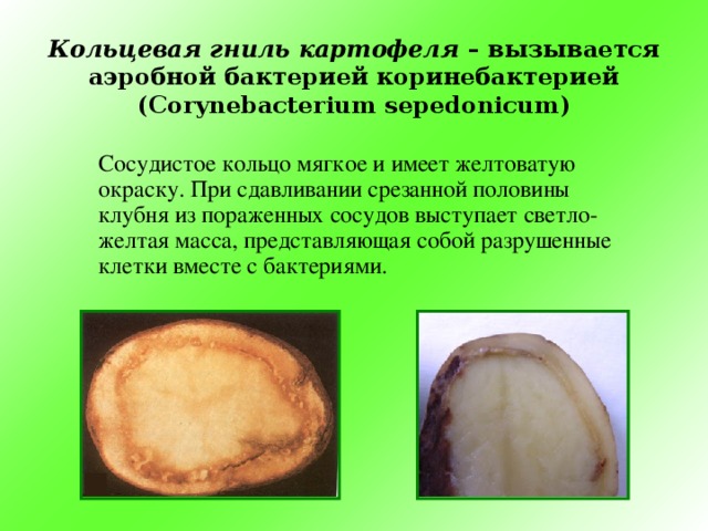 Кольцевая гниль картофеля – вызывается аэробной бактерией коринебактерией ( Corynebacterium sepedonicum)  Сосудистое кольцо мягкое и имеет желтоватую окраску. При сдавливании срезанной половины клубня из пораженных сосудов выступает светло-желтая масса, представляющая собой разрушенные клетки вместе с бактериями.