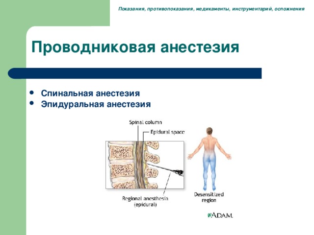 Показания, противопоказания, медикаменты, инструментарий, осложнения Проводниковая анестезия Спинальная анестезия Эпидуральная анестезия  ФИЛЬМ