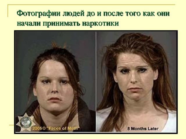 Фотографии людей до и после того как они начали принимать наркотики