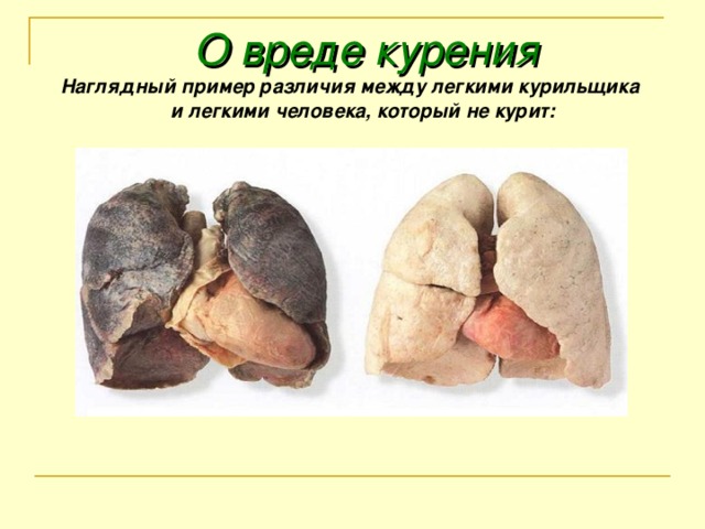 О вреде курения Наглядный пример различия между легкими курильщика и легкими человека, который не курит: