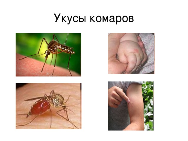 Укусы комаров