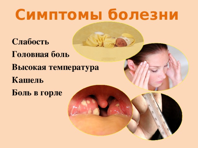 Симптомы болезни Слабость Головная боль Высокая температура Кашель Боль в горле