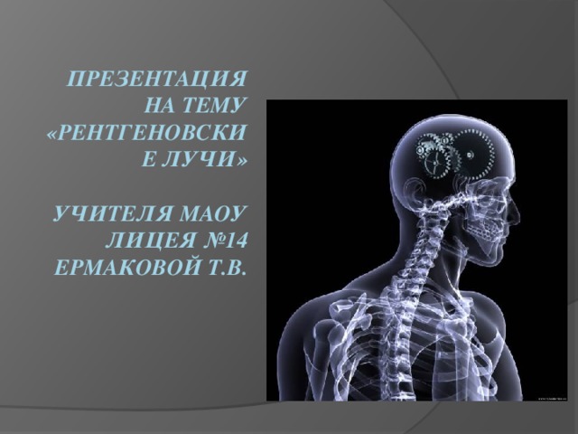 Презентация на тему «Рентгеновские лучи»   учителя МАОУ лицея №14  Ермаковой Т.В.