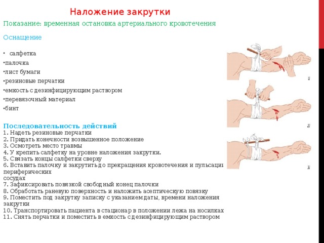 Наложение закрутки Показание: временная остановка артериального кровотечения   Оснащение   салфетка палочка лист бумаги резиновые перчатки емкость с дезинфицирующим раствором перевязочный материал бинт  Последовательность действий  1. Надеть резиновые перчатки  2. Придать конечности возвышенное положение  3. Осмотреть место травмы  4. У крепить салфетку на уровне наложения закрутки.  5. Связать концы салфетки сверху  6. Вставить палочку и закрутить до прекращения кровотечения и пульсации на периферических  сосудах  7. Зафиксировать повязкой свободный конец палочки  8. Обработать раневую поверхность и наложить асептическую повязку  9. Поместить под закрутку записку с указанием даты, времени наложения закрутки  10. Транспортировать пациента в стационар в положении лежа на носилках  11. Снять перчатки и поместить в емкость с дезинфицирующим раствором